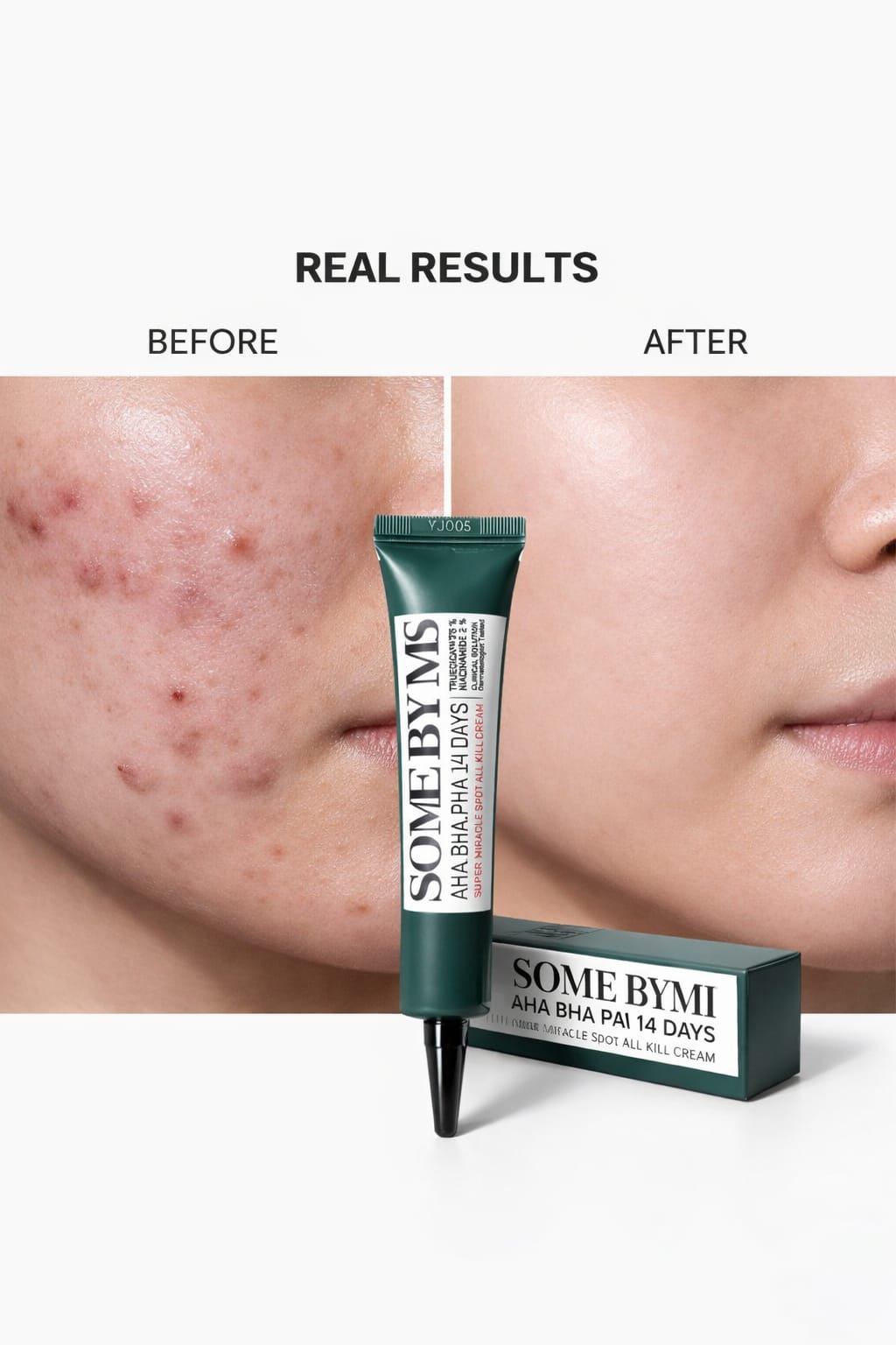 SOME BY MI AHA BHA PHA 14 Days Miracle Spot Cream – Acne Clearing, Pore Refining & Skin Repair Treatment