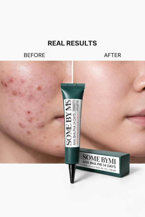 SOME BY MI AHA BHA PHA 14 Days Miracle Spot Cream – Acne Clearing, Pore Refining & Skin Repair Treatment